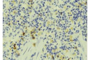 ABIN6273242 at 1/100 staining Human lymph tissue by IHC-P. (FAM65B anticorps)