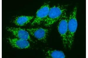 IF analysis of PMPCA/INPP5 using anti-PMPCA/INPP5 antibody (ABIN7602722). (PMPCA anticorps  (AA 99-525))