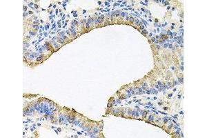 Immunohistochemistry of paraffin-embedded Mouse lung using SKAP2 Polyclonal Antibody at dilution of 1:100 (40x lens).