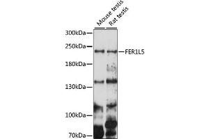 Western blot analysis of extracts of various cell lines, using FER1L5 antibody (ABIN7267166) at 1000 dilution. (FER1L5 anticorps  (AA 1350-1670))