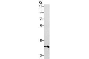 Western Blotting (WB) image for anti-Interleukin 1 Receptor-Like 1 (IL1RL1) antibody (ABIN2422347) (IL1RL1 anticorps)