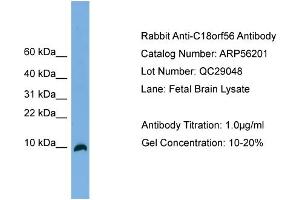WB Suggested Anti-C18orf56  Antibody Titration: 0. (C18orf56 anticorps  (N-Term))