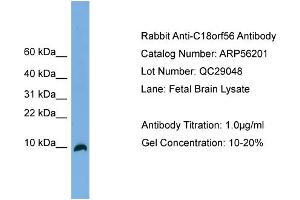 WB Suggested Anti-C18orf56  Antibody Titration: 0.