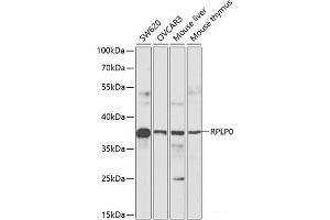 Western blot analysis of extracts of various cell lines using RPLP0 Polyclonal Antibody at dilution of 1:1000. (RPLP0 anticorps)