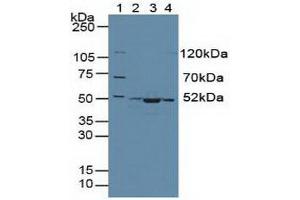 Western blot analysis of (1) Human 293T Cells, (2) Human HeLa cells, (3) Mouse Skeletal Muscle Tissue and (4) Human HepG2 Cells. (CS anticorps  (AA 174-428))