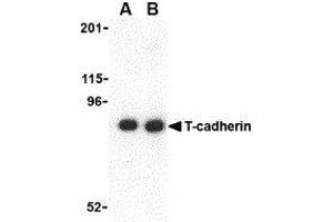 Western Blotting (WB) image for anti-Cadherin 13 (CDH13) (N-Term) antibody (ABIN2477830) (Cadherin 13 anticorps  (N-Term))