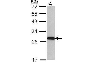 WB Image Sample (30 ug of whole cell lysate) A: Molt-4 , 12% SDS PAGE antibody diluted at 1:1000 (MYL3/CMLC1 anticorps)
