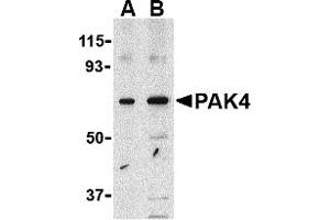 Western Blotting (WB) image for anti-P21-Activated Kinase 4 (PAK4) (Middle Region) antibody (ABIN1031030) (PAK4 anticorps  (Middle Region))