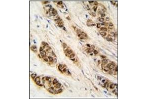 Image no. 2 for anti-DCTP Pyrophosphatase 1 (DCTPP1) (N-Term) antibody (ABIN357989) (DCTPP1 anticorps  (N-Term))