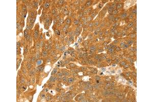 Immunohistochemistry (IHC) image for anti-Transmembrane Protein with EGF-Like and Two Follistatin-Like Domains 2 (TMEFF2) antibody (ABIN2434016) (TMEFF2 anticorps)
