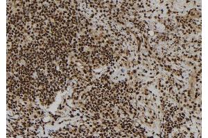 ABIN6277252 at 1/100 staining Human spleen tissue by IHC-P. (RPS3 anticorps  (Internal Region))