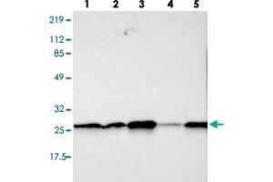 Western blot analysis of lane 1: RT-4, lane 2: U-251 MG, lane 3: A-431, lane 4: Liver and lane 5: Tonsil using SNAP23 polyclonal antibody . (SNAP23 anticorps)