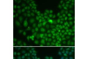 Immunofluorescence analysis of U2OS cells using CLU Polyclonal Antibody (Clusterin anticorps)