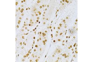 Immunohistochemistry of paraffin-embedded human stomach using DKC1 Antibody (ABIN5970956) at dilution of 1/200 (40x lens). (DKC1 anticorps)