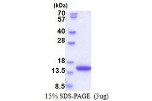 SDS-PAGE (SDS) image for Synaptojanin 2 Binding Protein (SYNJ2BP) (AA 1-117) protein (His tag) (ABIN5853559)