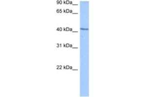 Western Blotting (WB) image for anti-DCP2 Decapping Enzyme Homolog (DCP2) antibody (ABIN2462345) (DCP2 anticorps)