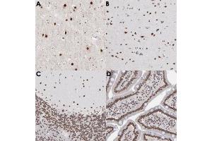 Immunohistochemical staining (Formalin-fixed paraffin-embedded sections) of human cerebral cortex (A, B), human cerebellum (C) and human duodenum (D) with ZNF3 polyclonal antibody . (ZNF3 anticorps)