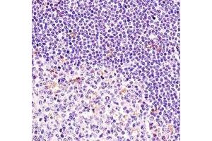 BTK antibody immunohistochemistry analysis in formalin fixed and paraffin embedded human tonsil tissue.