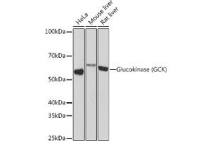 Western blot analysis of extracts of various cell lines, using Glucokinase (GCK) (GCK) Rabbit mAb (ABIN7267396) at 1:1000 dilution.