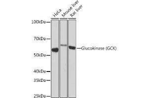 Western blot analysis of extracts of various cell lines, using Glucokinase (GCK) (GCK) Rabbit mAb (ABIN7267396) at 1:1000 dilution. (GCK anticorps)