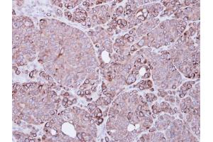 IHC-P Image Immunohistochemical analysis of paraffin-embedded SW480 xenograft, using BIRC4, antibody at 1:500 dilution.