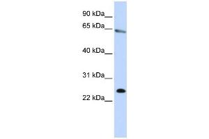Western Blotting (WB) image for anti-Zinc Finger Protein 326 (ZNF326) antibody (ABIN2458467) (ZNF326 anticorps)