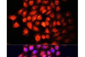 Immunofluorescence analysis of HeLa cells using IGF2 Polyclonal Antibody at dilution of 1:100 (40x lens). (IGF2 anticorps)