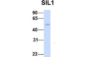 Host:  Rabbit  Target Name:  SIL1  Sample Type:  Human Fetal Heart  Antibody Dilution:  1. (SIL1 anticorps  (C-Term))