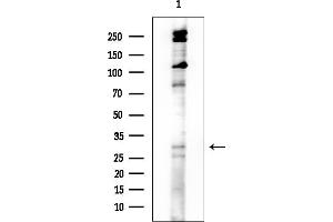 Western blot analysis of lysates from COLO205 cells, using TMEM101 Antibody at 1/1000 dilution.