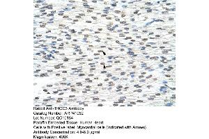 Rabbit Anti-THOC3 Antibody  Paraffin Embedded Tissue: Human Heart Cellular Data: Myocardial cells Antibody Concentration: 4. (THO Complex 3 anticorps  (Middle Region))