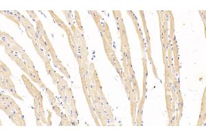 Detection of HBb in Mouse Cardiac Muscle Tissue using Polyclonal Antibody to Hemoglobin Beta (HBb)