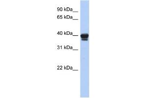 WB Suggested Anti-NAPE-PLD Antibody Titration: 0. (NAPEPLD anticorps  (N-Term))