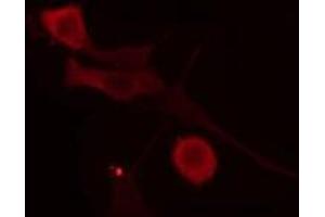 ABIN6275999 staining  COLO205 cells by IF/ICC.