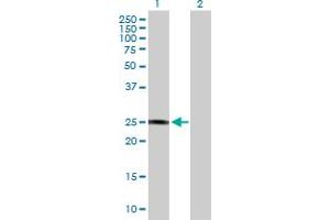 Western Blot analysis of GSTZ1 expression in transfected 293T cell line by GSTZ1 MaxPab polyclonal antibody. (GSTZ1 anticorps  (AA 1-216))