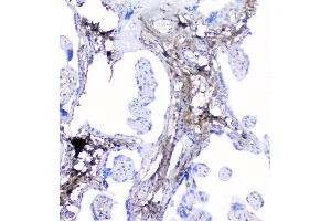 IHC analysis of Lumican using anti-Lumican antibody (ABIN6719339).