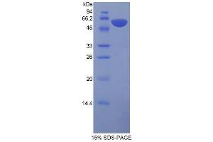 SDS-PAGE analysis of Rat Protein S Protein. (PROS1 Protéine)