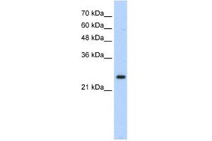 WB Suggested Anti-HOXB7 Antibody Titration: 1.