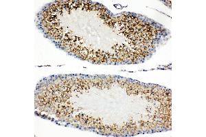 Anti-TIM 1 antibody, IHC(P) IHC(P): Rat Testis Tissue (HAVCR1 anticorps  (C-Term))
