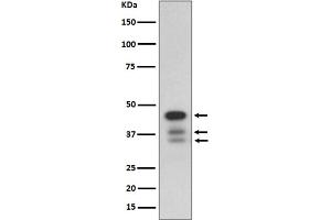 Western blot analysis of cleaved Caspase-9 Antibody expression in HeLa cell lysate treated with staurosporine.