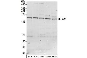 anti-Stromal Antigen 1 (STAG1) (AA 25-75) antibody