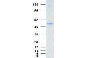 Validation with Western Blot