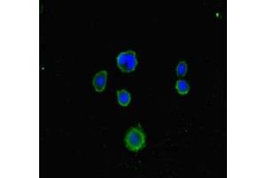 Immunofluorescent analysis of MCF-7 cells using ABIN7158049 at dilution of 1:100 and Alexa Fluor 488-congugated AffiniPure Goat Anti-Rabbit IgG(H+L) (LRCH1 anticorps  (AA 1-105))