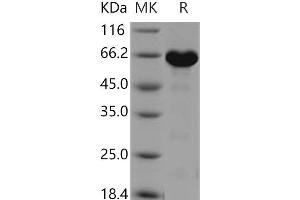 Western Blotting (WB) image for Mitogen-Activated Protein Kinase 12 (MAPK12) protein (GST tag,His tag) (ABIN7317046) (MAPK12 Protein (GST tag,His tag))