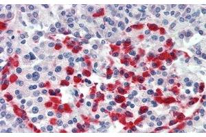 Detection of ITGb6 in Human Pancreas Tissue using Polyclonal Antibody to Integrin Beta 6 (ITGb6)