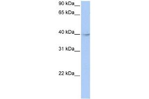 WB Suggested Anti-ZBTB6 Antibody Titration:  0. (ZBTB6 anticorps  (Middle Region))
