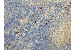 Immunohistochemical staining (Formalin-fixed paraffin-embedded sections) of human lymphoid tissue with Human IgG4 monoclonal antibody, clone RM120  under 5 ug/mL working concentration. (Lapin anti-Humain Immunoglobulin Heavy Constant gamma 4 (G4m Marker) (IGHG4) Anticorps)