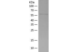 Western Blotting (WB) image for Protein Phosphatase 1, Catalytic Subunit, gamma Isoform (PPP1CC) (AA 1-323) protein (His-IF2DI Tag) (ABIN7124668)