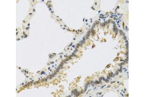 Immunohistochemistry of paraffin-embedded Rat lung using RSPO1 Polyclonal Antibody at dilution of 1:100 (40x lens). (RSPO1 anticorps)