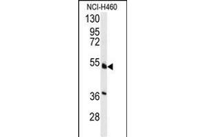 Western blot analysis of anti-HNF4A Antibody  (ABIN389268 and ABIN2839401) in NCI- cell line lysates (35 μg/lane). (HNF4A anticorps  (AA 118-146))