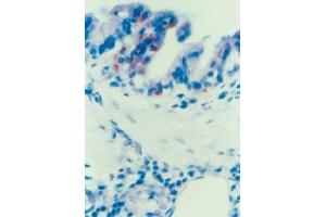 Immunohistochemical staining of Parainfluenza Typ 3 (PIV-3) in Lung epithelial cells (Guinea pig) (Parainfluenza Virus Type 3 anticorps)